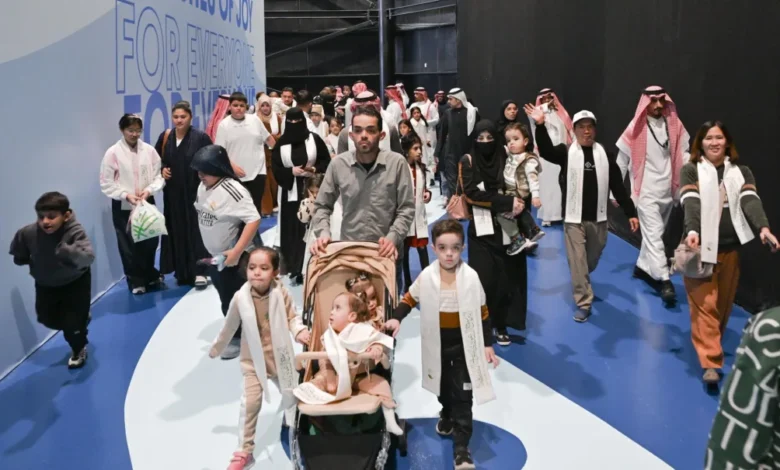 التوائم الملتصقة