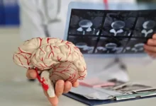 الدماغ البشري